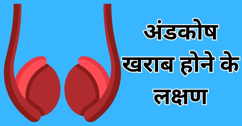 अंडकोष खराब होने के लक्षण : कैसे बचे ! 10 नियम जिसे अपनाने से कभी नहीं आएंगे ये लक्षण 1 अंडकोष खराब होने के लक्षण