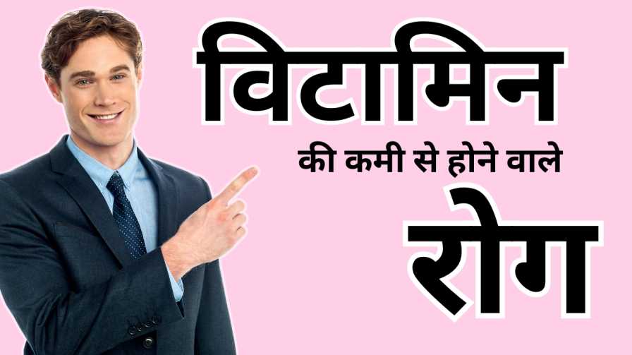 विटामिन की कमी से होने वाले रोग विटामिन की कमी से होने वाले रोग